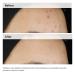 The Ordinary Balancing & Clarifying Serum for Blemish Prone Skin 1.0 oz - Discover Premium Quality Shop now! - Buy Online on GoSupps.com