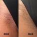 Bushbalm Radiant Reset Toner Pads for Dark Spots & Ingrown Hairs 30 ct - Transform Your Style with the Best Innovation Today! - Buy Online on GoSupps.com