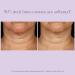 Exuviance AGE REVERSE+ Toning Neck Cream - Discover Premium Quality Shop now! - Buy Online on GoSupps.com
