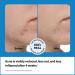 Discover Peach Slices 3-Step Acne Starter Kit - Elevate Your Style Instantly! - Buy Online on GoSupps.com
