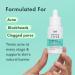 Discover Rael Miracle Clear Complete Acne Serum 1.0 oz - Elevate Your Style Instantly! - Buy Online on GoSupps.com