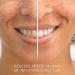 Moon Teeth Whitening Pen Duo - Transform Your Style with the Best Innovation Today! - Buy Online on GoSupps.com