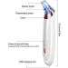 QINERSAW Blackhead Remover Pore Cleaner Blackheads Pore Sucker with 5 Suction Heads Acne Comedone Extractor Kit Blackhead Removal Tool for Beauty Salon (Color : Red) (Color : Red) - Buy Online on GoSupps.com