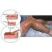 Voltafas Mebo Burn Fast Pain Relief Healing Cream 15g - No Marks, Fast-Acting Formula - Buy Online on GoSupps.com