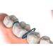 Fencia 1000 Pcs Blue Dental Orthodontic Separator Elastic Bands - Premium Quality - Buy Online on GoSupps.com