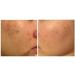 Avene Cicalfate Repair Cream Hypoallergenic for Sensitive & Irritated Skin 100 ml - Buy Online on GoSupps.com