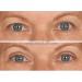 EasyLift Instant Eye Lift - Visible Results in Seconds - Buy Online on GoSupps.com