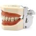 Samnuerly Dental Removable Adult Teeth Model | Dentist Standard Teaching Material & Oral Gum Practice Model - Buy Online on GoSupps.com