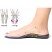 Flat Foot Orthopedic Insoles for Men & Women | Arch Support Inserts | EVA Sports Shoe Pads (46-48 - Buy Online on GoSupps.com