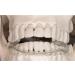 Buy Twin-Splint CMD Rails 2in1 - Effective Aquasplint for Bruxism & Joint Pain Relief | International Shipping - Buy Online on GoSupps.com