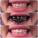 Bamboo Charcoal Toothpaste - Natural Teeth Whitener Eco-Friendly Oral Care International Shipping - Buy Online on GoSupps.com