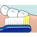TEPE Nova Extra Soft Toothbrush | Effective & Thorough Tooth Cleaning - International Shipping Available - Buy Online on GoSupps.com