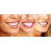Teeth Whitening Gel Syringe Refill Pack - 44% Carbamide Peroxide - 10ml Syringes - 3 XL 10cc - Bright White Smiles - Buy Online on GoSupps.com