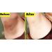 Aohoyaca 2pcs Crema Blanqueadora Corporal y Aclaradora de Piel | Para Manchas en Cara, Axilas, Cuello y Entrepierna | Eficaz para Axilas y Rodillas - Buy Online on GoSupps.com