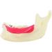 DYTAH Pathological Teeth Model - Right Oral Mandibular Communication for Medical Science - Buy Online on GoSupps.com