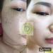 02 boxes *100ml - S c M c Lam Ph p m u t thi n nhi n- C th o d c c tr m n- n m- t n nhang S c M c Lam- Natural herbal remedy dark acne skin melasma - Ship from USA 7-14 days - Buy Online on GoSupps.com