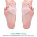 SILICONE Bunion Corrector Toe Separators - Day/Night Use - 1 Pair - Buy Online on GoSupps.com