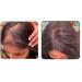 Fast Hair Growth Serum | Prevent Hair Loss & Thinning | Targets Alopecia & Hairline Issues | Postpartum & Seasonal Care Oil - Buy Online on GoSupps.com