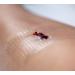 Silicone Net Dressing 10x7.5cm x 5 for Skin Tears, Scars, Surgical Wounds, and Ulcers - Pack of 5 - Buy Online on GoSupps.com