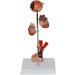 Body Model Diabetes Diabetes Diabetic Body Model Pathological Anatomical Model 5 Rooms Removable Human Anatomy Science Diabetes