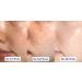 WhiteSilk Power Ampule with Stem Cell Complex, Bakuchiol, Vitamin C, and Melatonin - 10ml x 5 vials - Buy Online on GoSupps.com