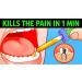 Anadent Toothache Gel 20% Benzocaine Oral Gel | Fast Acting Pain Relief for Cavity, Toothache & Canker Sores 0.25oz - Buy Online on GoSupps.com