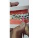 3/16 Neon Orthodontic Elastic Rubber Bands 300-Pack - Medium Force - Ideal for Bows, Dreadlocks, Doll Hair, Braids - Free Elastic Placer Included - Buy Online on GoSupps.com