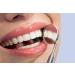Non-Peroxide Teeth Whitening Gel with LED Light - Set of 10 Syringes for Fast Results - Buy Online on GoSupps.com