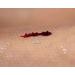 Silicone Net Dressing 10x7.5cm x 5 for Skin Tears, Scars, Surgical Wounds, and Ulcers - Pack of 5 - Buy Online on GoSupps.com