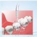 VINFANY 4pcs Water Jet Orthodontic Tips for Waterpik WP-70/70E - Precision Dental Care Solution - Buy Online on GoSupps.com