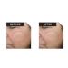 Buy Mary Kay Clinical Solutions Retinol Set 0.5 & 2.5 - Best International Shipping - Buy Online on GoSupps.com