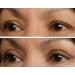 EasyLift Instant Eye Lift - Visible Results in Seconds - Buy Online on GoSupps.com