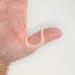 ArthroEze Oval Peach Thumb Splint For Trigger Thumb - Mallet Thumb - Thumb Hypermobility - Thumb Arthritis Size 8.5-58.1mm CIRCUMFERENCE SIZE 8.5 - (58.1mm CIRC)