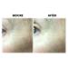 Rapid Reduction Eye Cream - Tightens Skin & Smooths Wrinkles for a Flawless Look | Shop Internationally - Buy Online on GoSupps.com