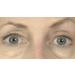 Butterfly Invisible Double Eye Lift - Instant Eye Lift Adhesive Strips - Buy Online on GoSupps.com