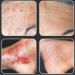 Cocoon Hydrating Body Cream for Dry Skin Issues - Dermatitis, Eczema, Psoriasis, Burns, Scars - Restoring and Healing Formula with Amino Acids - Buy Online on GoSupps.com