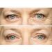 Eye Magic Original Eye Lift Kit - Small/Medium Size with Gel | Lifts Droopy Eyelids | Made in USA - Buy Online on GoSupps.com