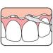 Tepe Bridge & Implant Floss - Premium Oral Care for Bridges and Implants - Buy Online on GoSupps.com