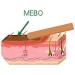 Voltafas Mebo Burn Fast Pain Relief Healing Cream 15g - No Marks, Fast-Acting Formula - Buy Online on GoSupps.com