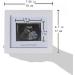 Love at First Sight Sonogram Photo Frame - Ideal Gift for Expecting Parents and Baby Shower - Gender Reveal Party Decor (Silver/White) - Buy Online on GoSupps.com