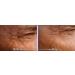 True Radiance Lineless Eye Cream - Reduces Crows Feet, Dark Circles & Puffiness - Anti-Wrinkle Formula with Reguage, Syncoll, Pepha-tight & Dmae - Paraben-Free - 1/2 Oz - Buy Online on GoSupps.com