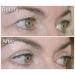 Eye Magic Original Eye Lift Kit - Small/Medium Size with Gel | Lifts Droopy Eyelids | Made in USA - Buy Online on GoSupps.com