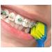 Buy Curaprox CS 5460 Ortho Toothbrush Pack of 2 - Assorted Colors | International Shipping Available - Buy Online on GoSupps.com