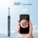Note5 Ear Wax Tweezers with Camera | Ear Cleaner Otoscope Kit with Light | 6 Earwax Removal Tools & 12 Spoons for Family Use - Buy Online on GoSupps.com
