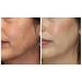 Mary Kay TimeWise Microdermabrasion Set - Refine & Pore Minimizer | U Happy - Shop Internationally - Buy Online on GoSupps.com