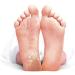 Balea Callus Remover Socks - Effective Callus Removal | 1 Pair (2 Pieces) for Soft Smooth Feet - Buy Online on GoSupps.com