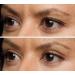 Eye Magic Original Eye Lift Kit - Small/Medium Size with Gel | Lifts Droopy Eyelids | Made in USA - Buy Online on GoSupps.com
