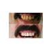 FAST WHITE NATURAL TEETH WHITENING Economical 10 Ml Teeth Whitening and Tartar Cleaning - Buy Online on GoSupps.com