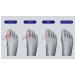 KOTALS Bunion Corrector Brace Splint Pads & Toe Separators - White (1 Pack) - Buy Online on GoSupps.com