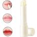 1PC Lip Balm Dark Lip Repair Treatment Lips Lightening Cream Lip Whitening Moisturizer - Buy Online on GoSupps.com